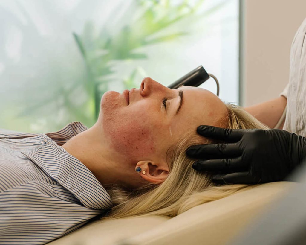 How To Get Glowing Skin: 5 Proven Steps That Actually Work 4 Skin Needling