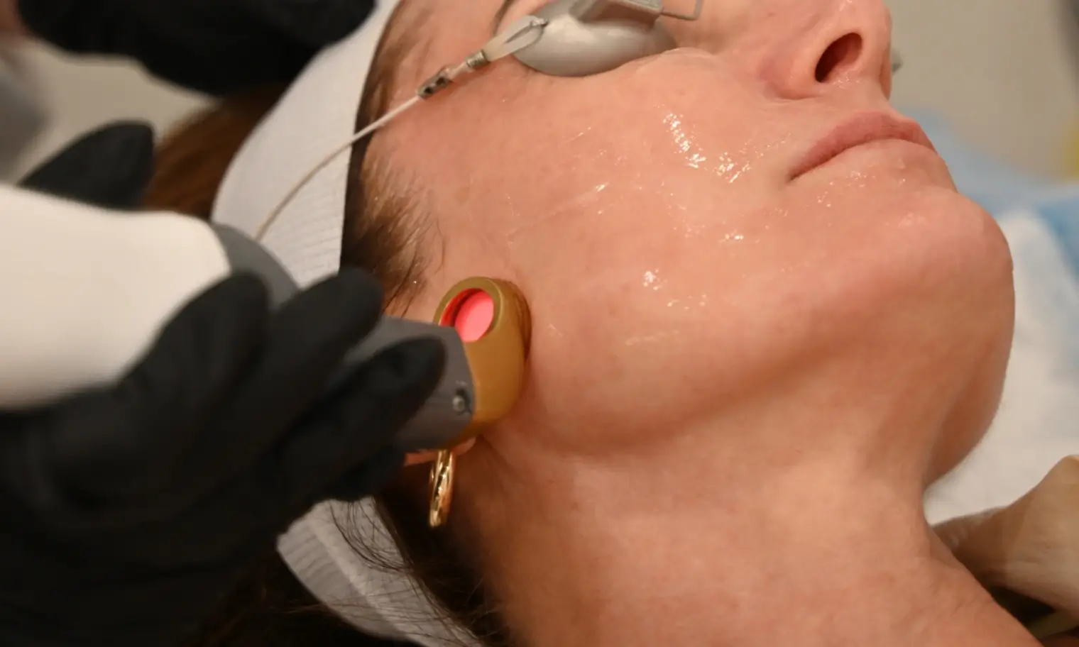 Laser device shown in a vascular concerns care setting